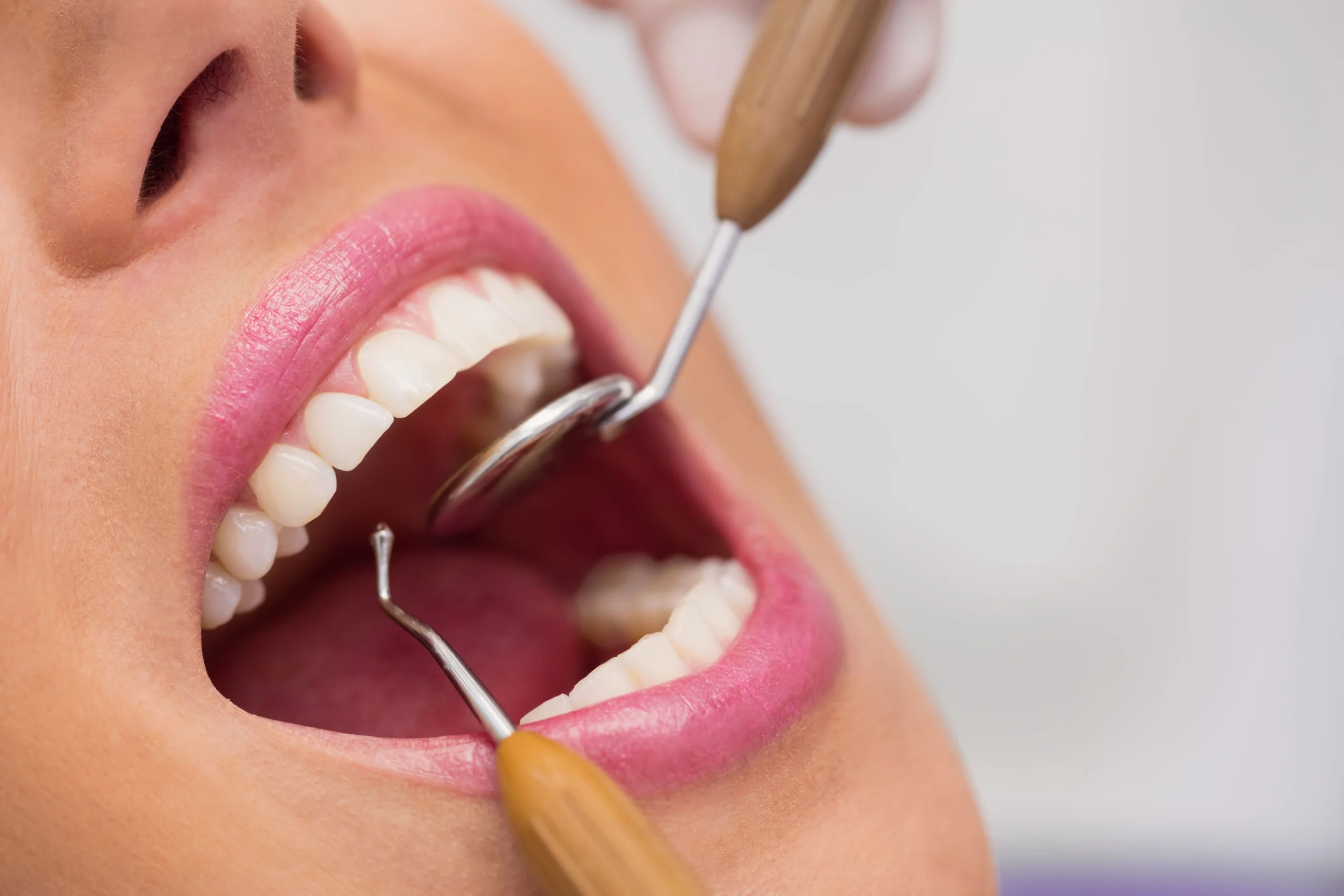 cura para la periodoncia en vallecas periodontitis